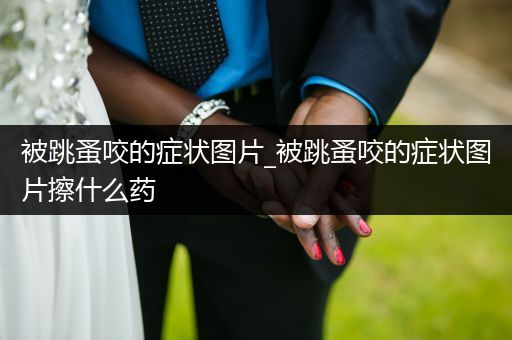 被跳蚤咬的癥狀圖片_被跳蚤咬的癥狀圖片擦什么藥