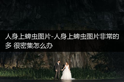 人身上蜱蟲圖片-人身上蜱蟲圖片非常的多 很密集怎么辦